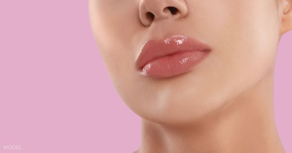 A close up of a woman's plump and beautifully full lips after lip filler. (Model)