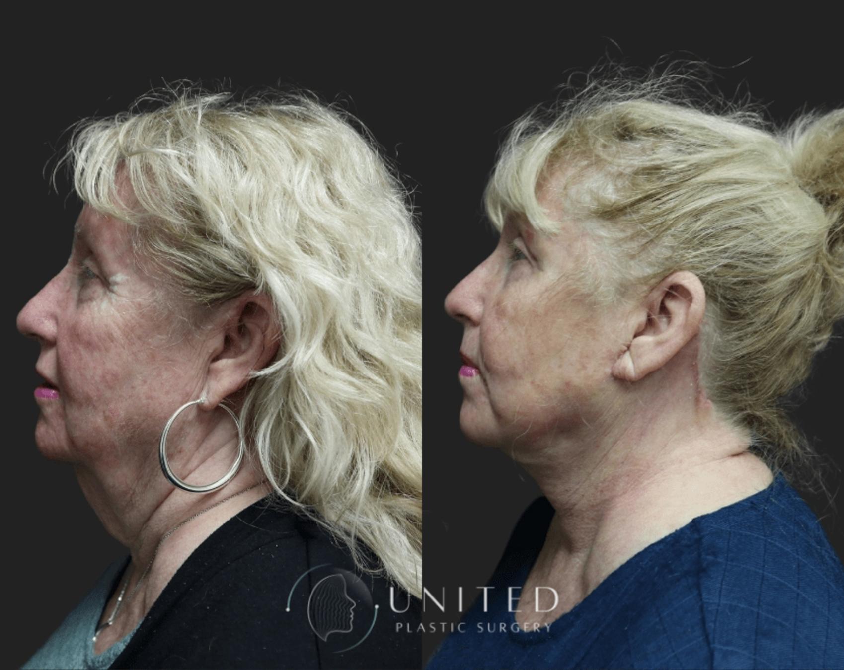Before & After image 3