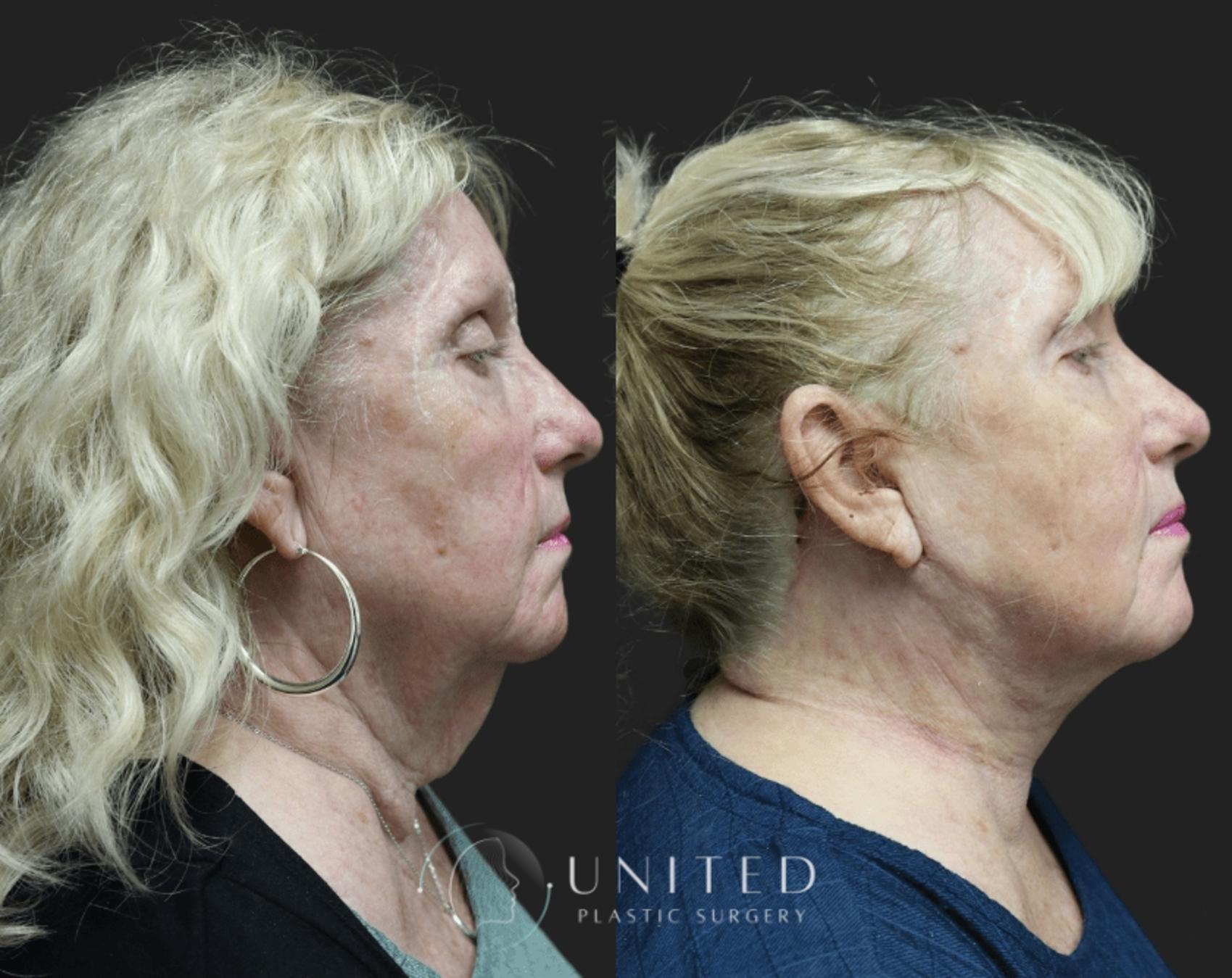 Before & After image 2