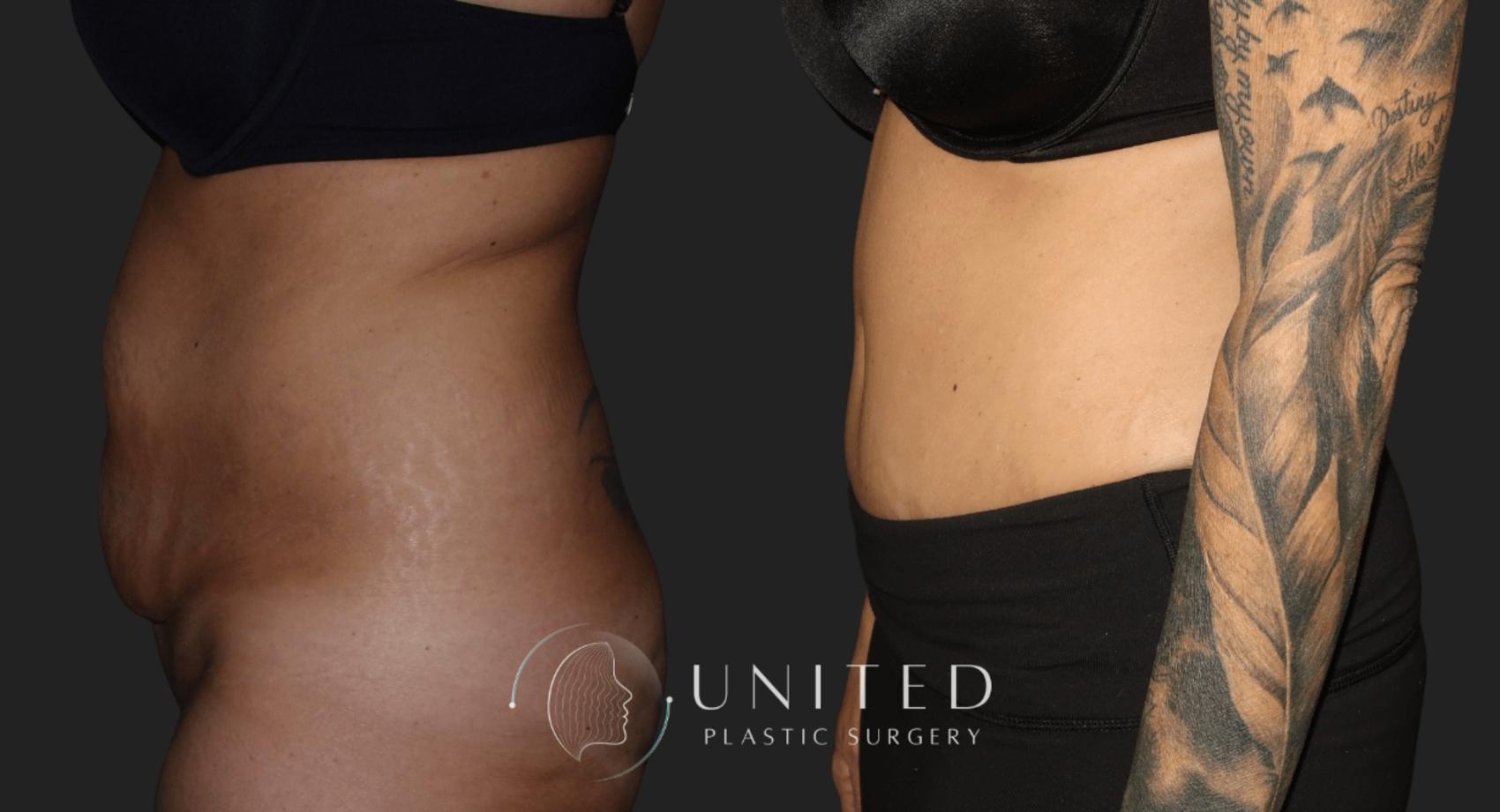 Before & After image 2