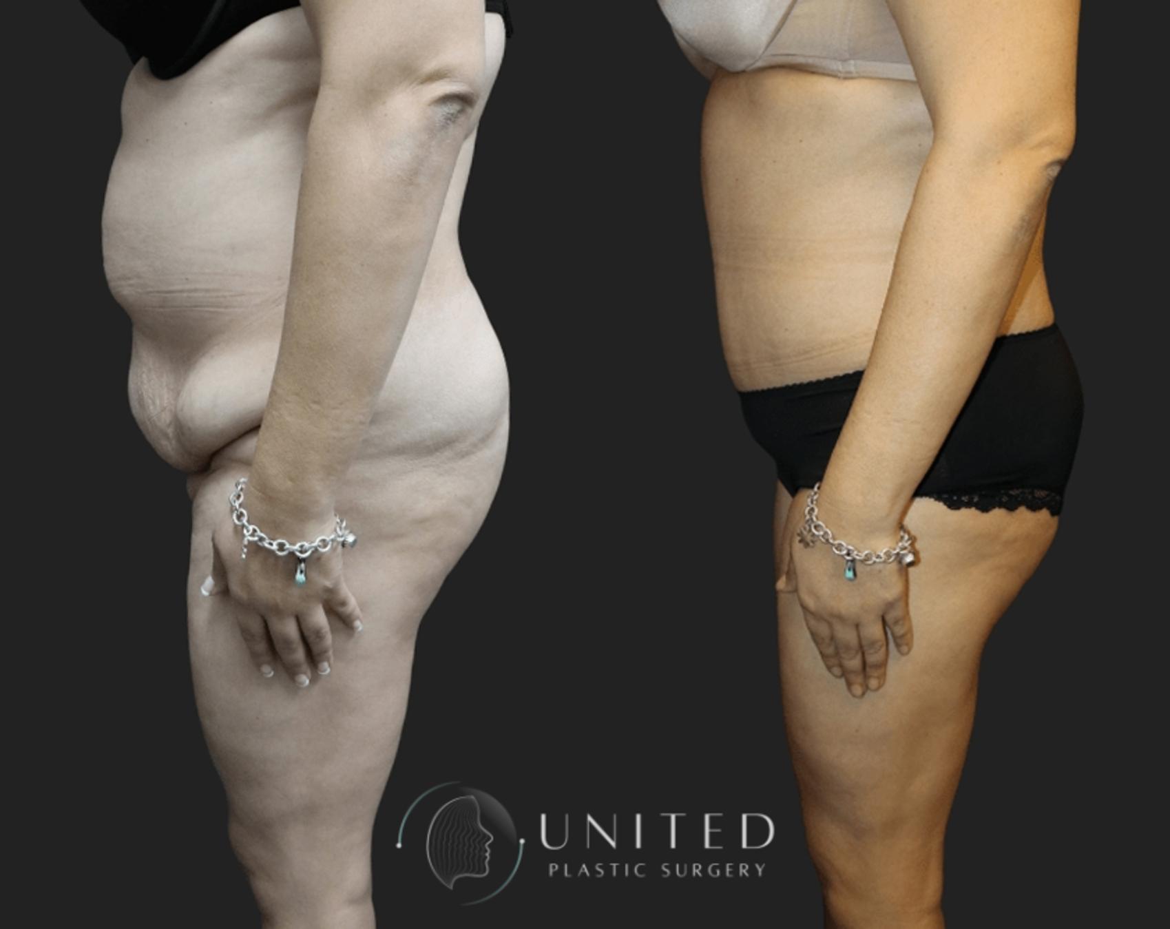 Before & After image 3