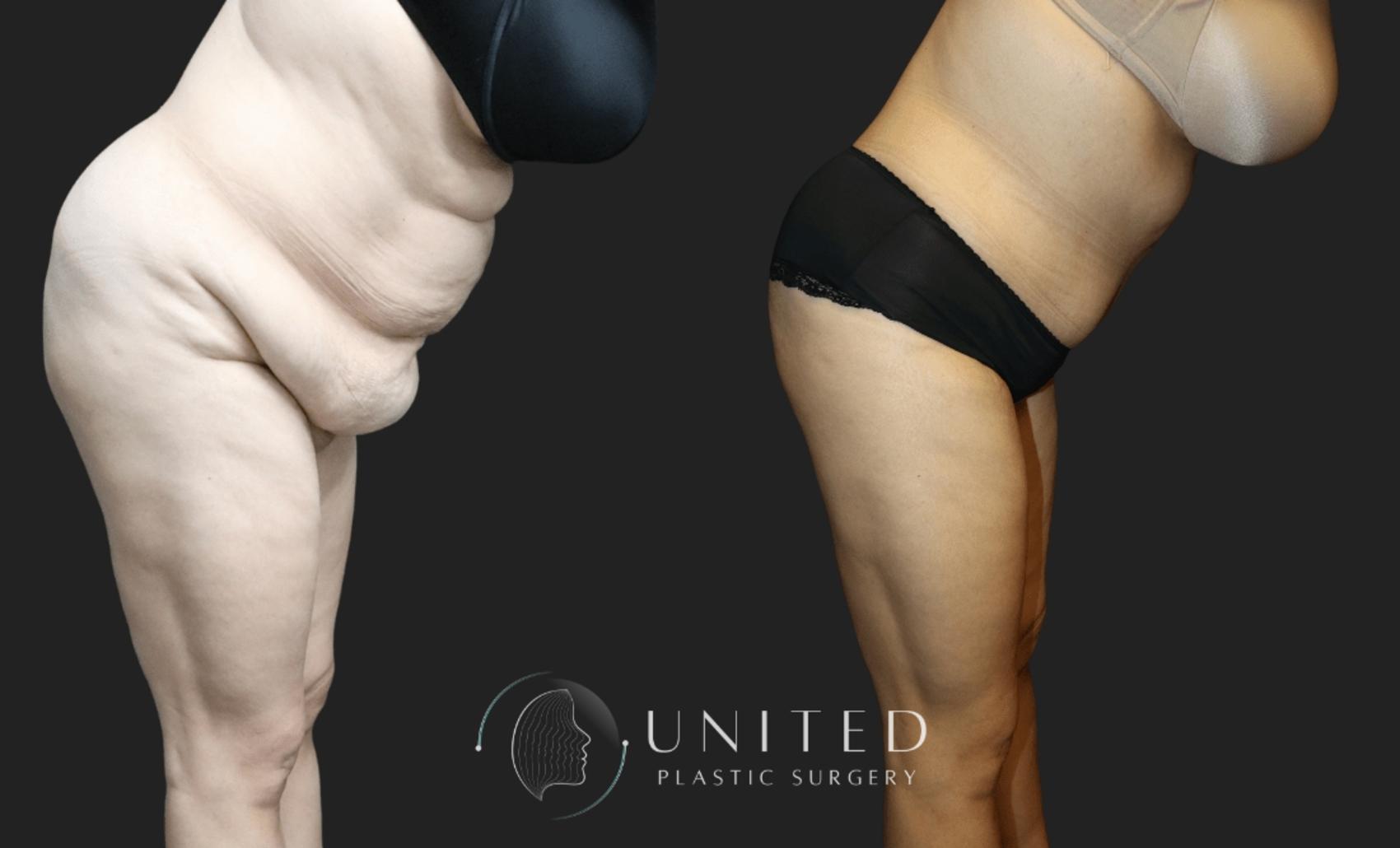 Before & After image 4