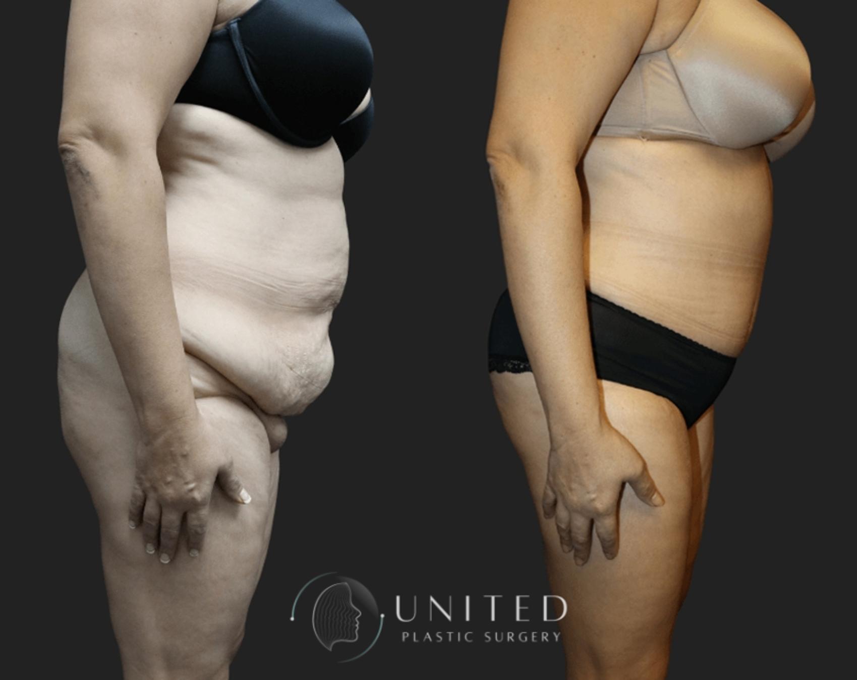 Before & After image 5
